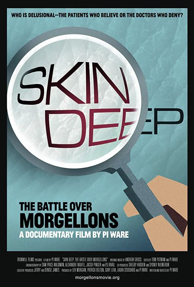Skin Deep: The Battle Over Morgellons Image